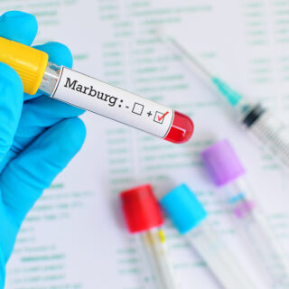 Marburg virus outbreak.