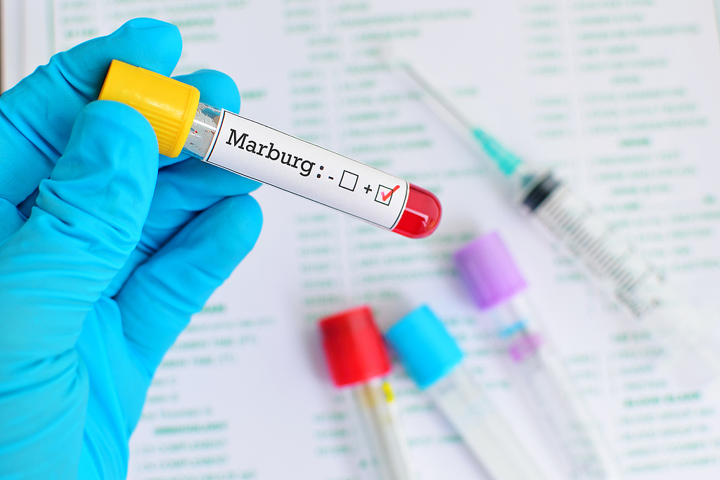 Marburg virus outbreak.